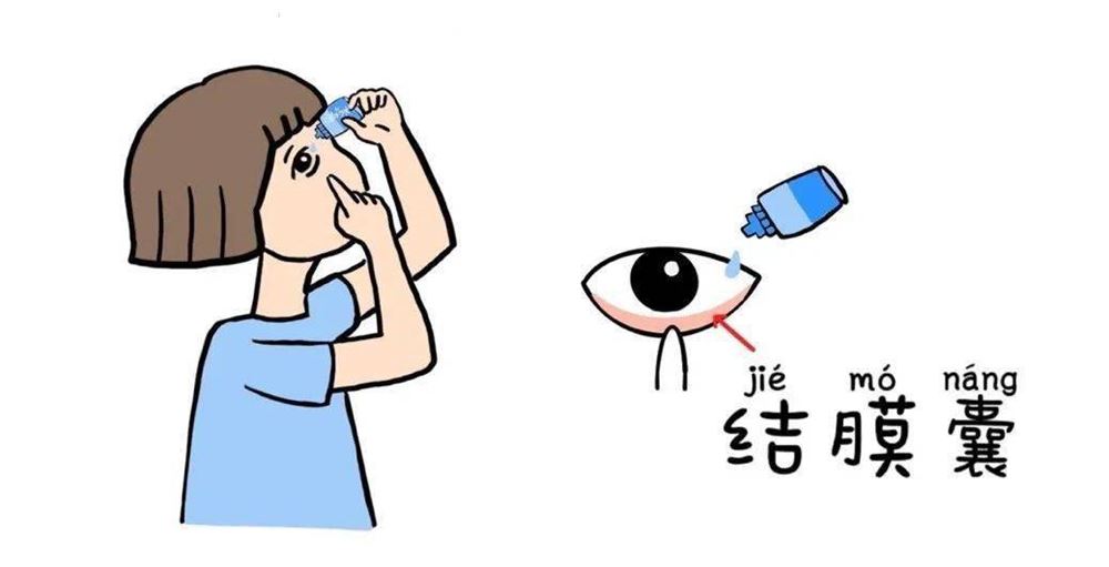 眼药水能直接滴在黑眼球上吗？